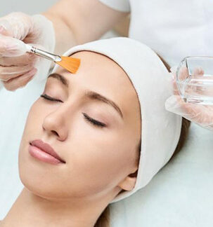 Chemical Peels