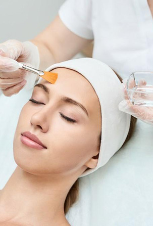 chemical peel