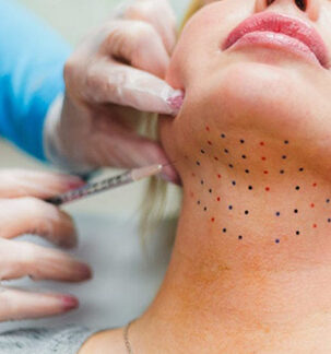Kybella