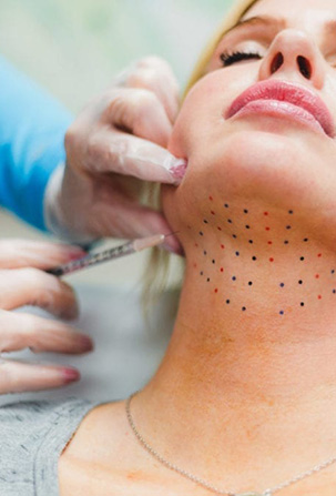 Kybella